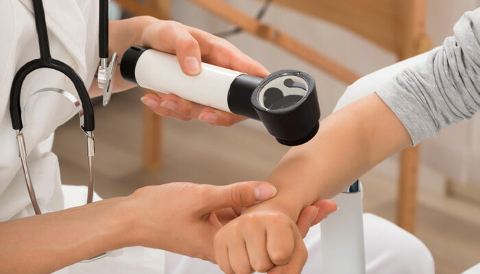 Eczema – Causes, Symptoms, Management, and More