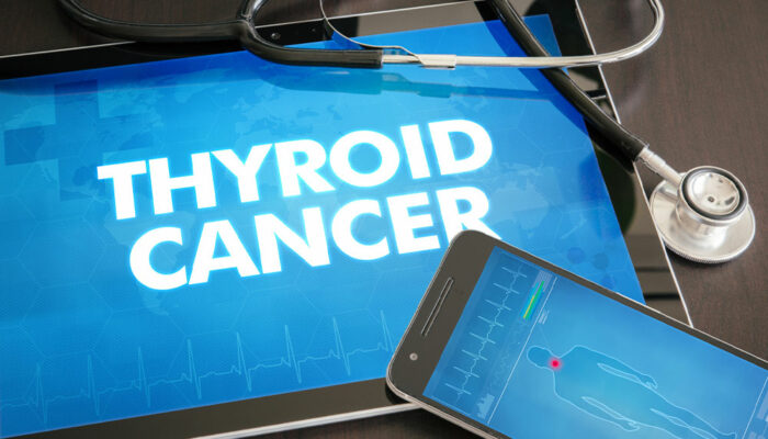 Various Aspects of Thyroid Cancer