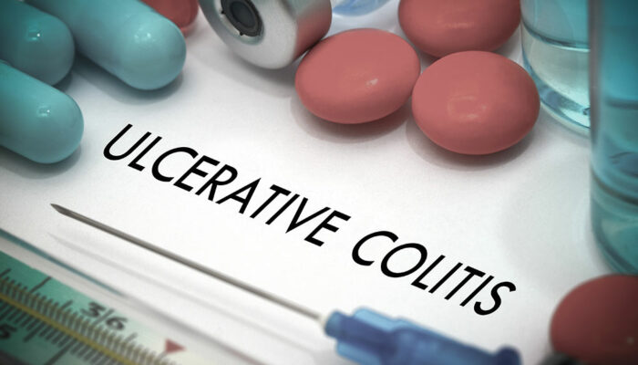 5 Foods That Help Manage Ulcerative Colitis and Crohn’s Disease