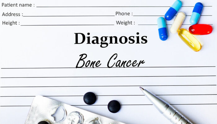 Bone cancer – Types, warning signs, lifestyle tips, and more