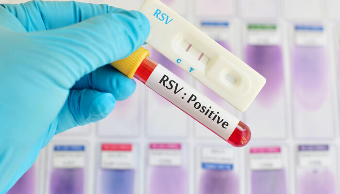 9 ways to improve immunity against severe respiratory viruses