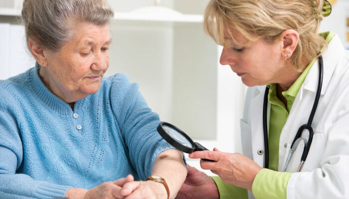 14 silent warning signs of skin cancer