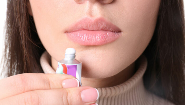 Top 8 cold sore remedies