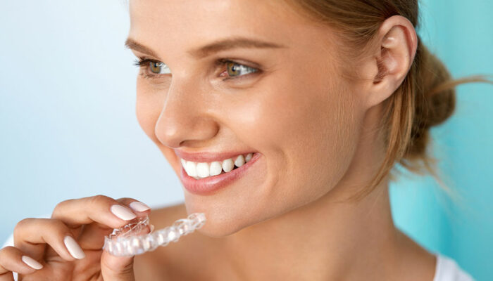 Invisible dental aligners – Benefits and tips to follow